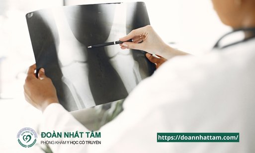 Bí Quyết Giảm Đau Khớp Gối Ngay Lập Tức Tại Nhà (Không Cần Thuốc!) (2)