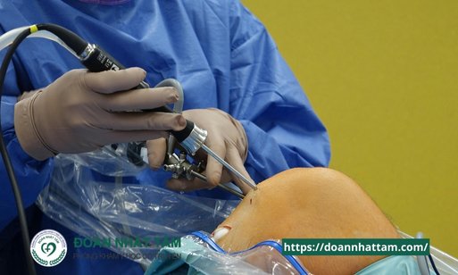 Bí Quyết Giảm Đau Khớp Gối Ngay Lập Tức Tại Nhà (Không Cần Thuốc!) Bí Quyết Giảm Đau Khớp Gối Ngay Lập Tức Tại Nhà (Không Cần Thuốc!)