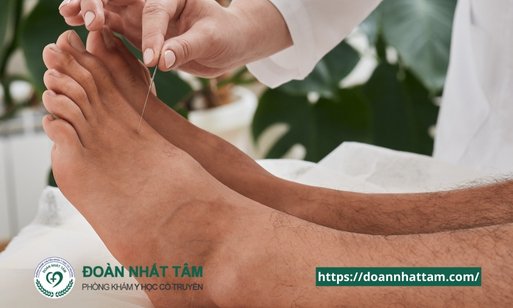 Châm Cứu Có Thật Sự Hiệu Quả Giải Mã Bí Ẩn Về Kim Châm Trị Liệu (3) Châm Cứu Có Thật Sự Hiệu Quả Giải Mã Bí Ẩn Về Kim Châm Trị Liệu (3)