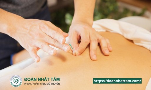 Sự Thật Bất Ngờ Về Châm Cứu Không Chỉ Giảm Đau Mà Còn Chữa Bách Bệnh! (2)