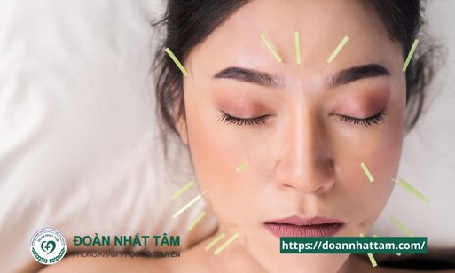 Sự Thật Bất Ngờ Vhttps doannhattam.com ề Châm Cứu Không Chỉ Giảm Đau Mà Còn Chữa Bách Bệnh!
